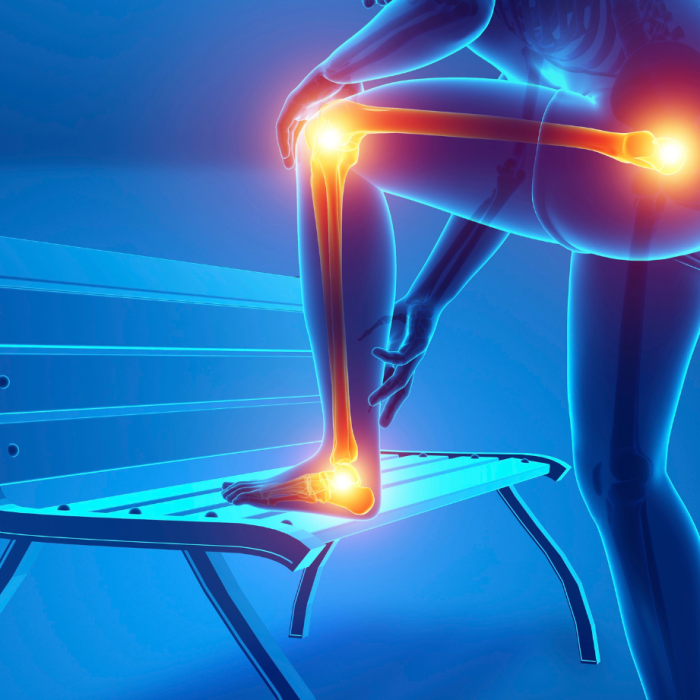 Exercício de fortalecimento para glúteo médio e dor no joelho